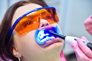 albire dentara laser