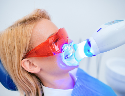 Cât costă albirea dentară la Clinicile DENTESSE? Prețuri și opțiuni disponibile