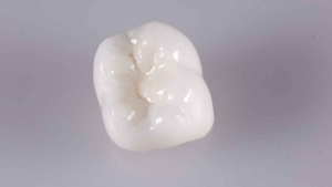 coroana ceramica