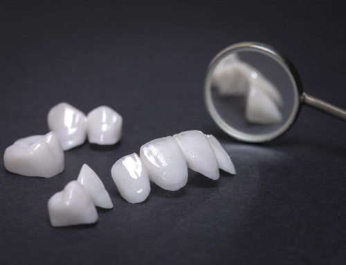 Coroană zirconiu vs ceramică – ghid comparativ pentru pacienți