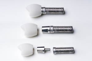 implant vs punte dentara