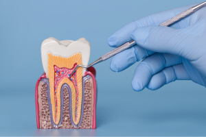 sensibilitatea dentară