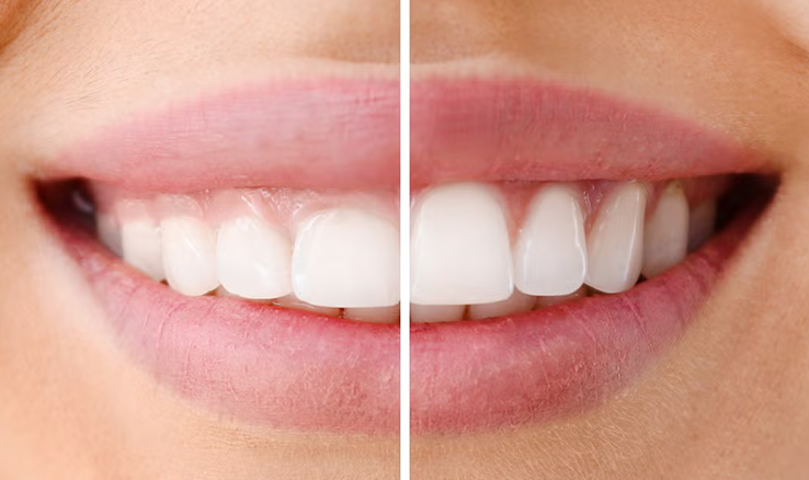 skilled-male-dentist-showing-x-ray-picture-teeth-woman 12 Corectarea zâmbetului gingival cu laser