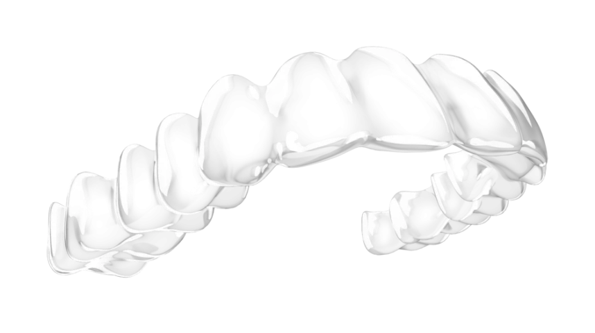 tarife_aparat_spark_desk spark