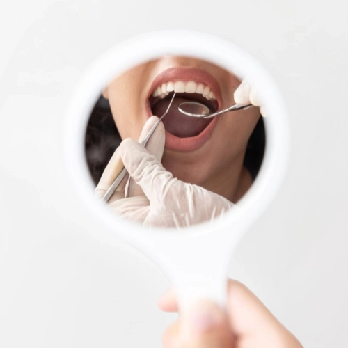 voucher cosultatie stomatologica in clinica dentesse